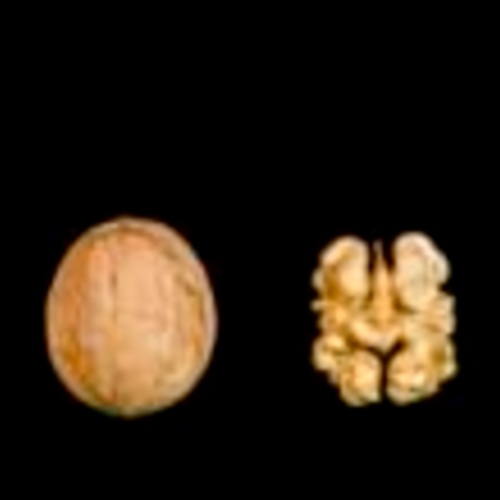 Walnuts