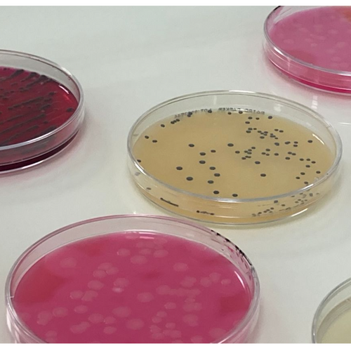 Biokar By Solabia-Microbiology Testing